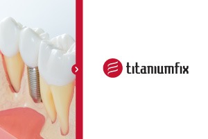 Titaniumfix